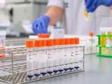 'Nederlandse experts vrezen tekorten van labmateriaal coronatests'