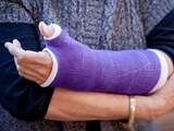 Spontaan je arm gebroken? 'Vraag arts naar botontkalking'