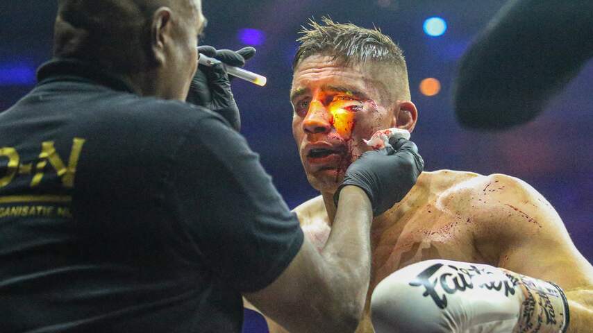 Rico Verhoeven