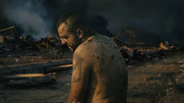 A wounded man who was injured in a major explosion in the Lebanese capital Beirut.  In the background firefighters try to extinguish the fire.