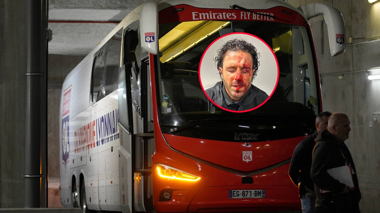 Colère en France suite aux bombardements du bus des joueurs lyonnais : « Ce sont des idiots téméraires » |  Football