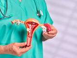 Australische wetenschappers bereiken doorbraak in behandeling endometriose