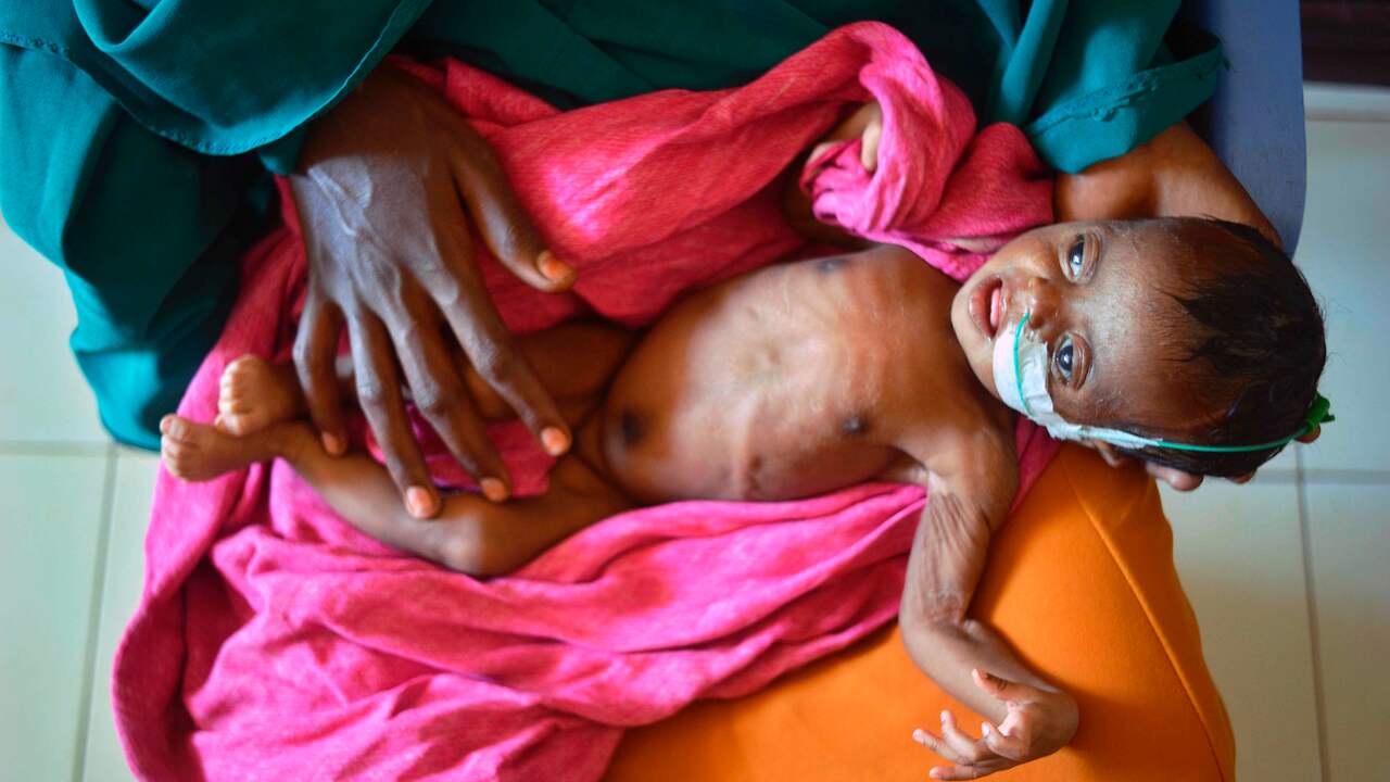 Drie oorzaken van de huidige hongersnood in Afrika