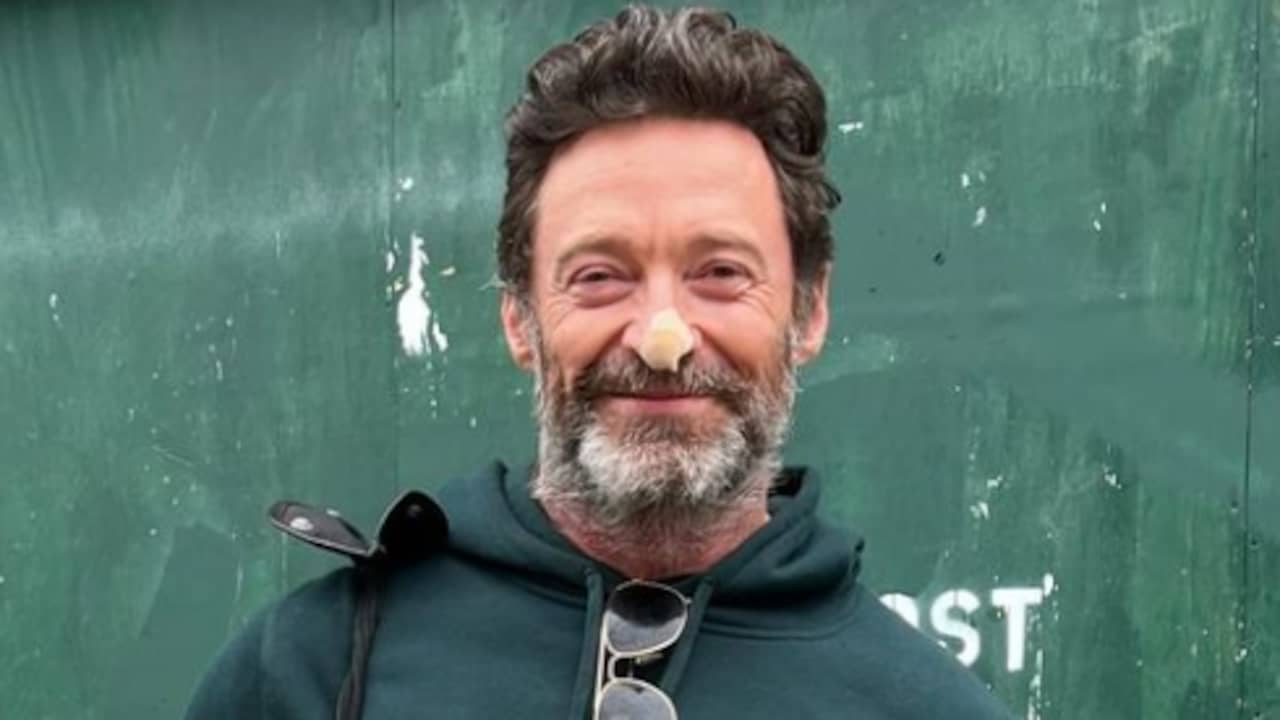 Hugh Jackman’s Suspicious Cells are Not Skin Cancer, Actor Announces on Instagram