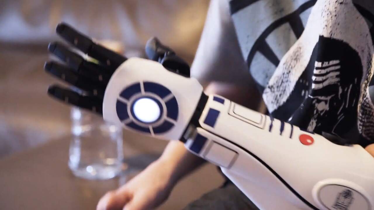 Britse jongen krijgt eerste robotarm met officieel Star Wars-design