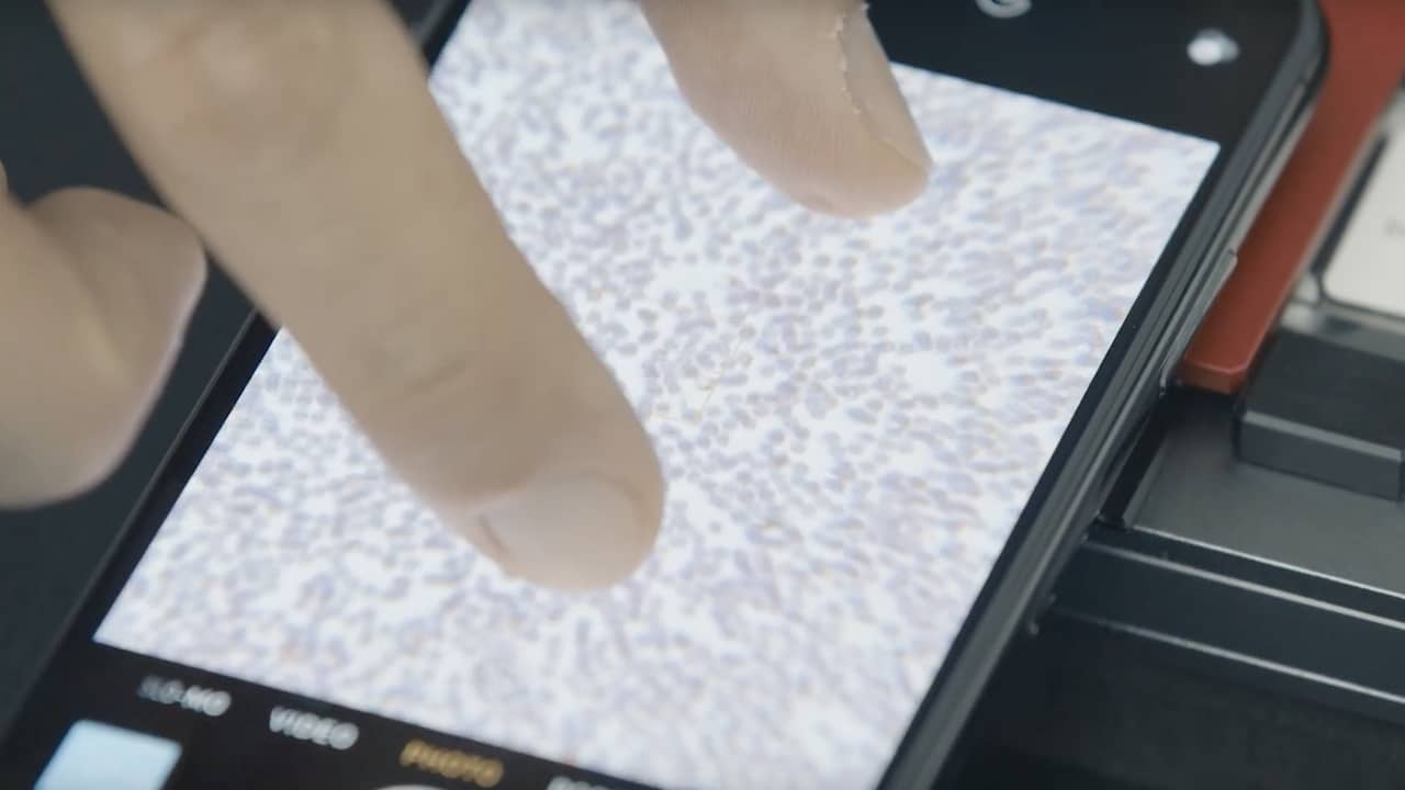 Gadget verandert telefoon in microscoop