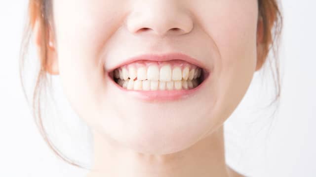 Zorgt bepaalde tandpasta echt voor wittere tanden? Het laatste nieuws het eerst op NU.nl